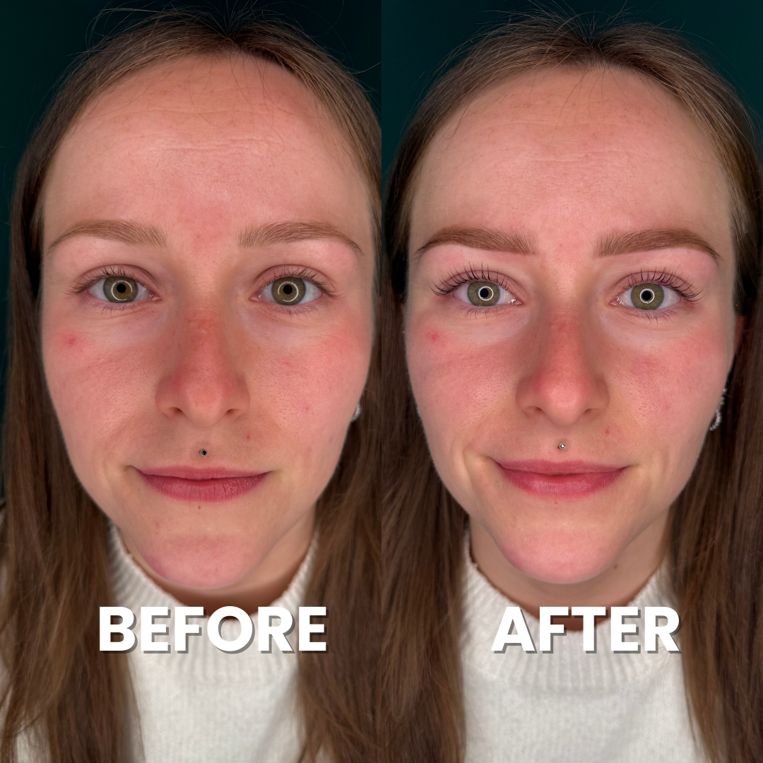 EasyLiftAcademy: Die umfangreichste Brow Lift Online Schulung